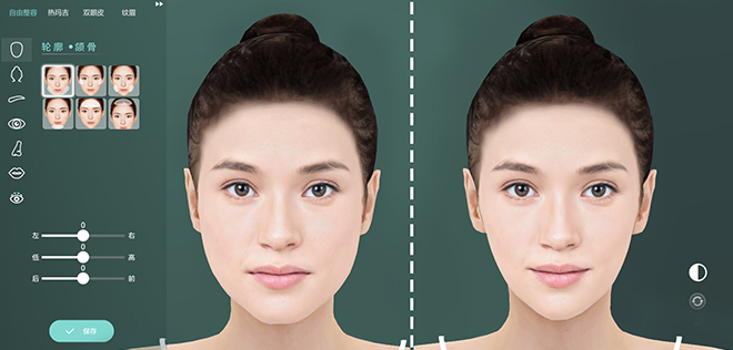 什么是數(shù)字3D整形？